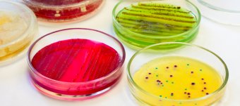 Культивирование Бактерий Микробиология