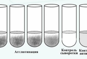 Серологические Реакции Микробиология